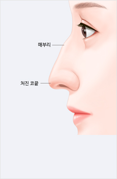 코 이미지