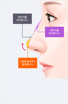 코 이미지
