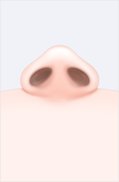 코 이미지