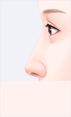 코 이미지