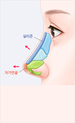 코 이미지
