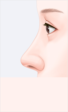 코 이미지