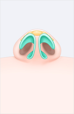 코 이미지