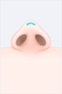 코 이미지